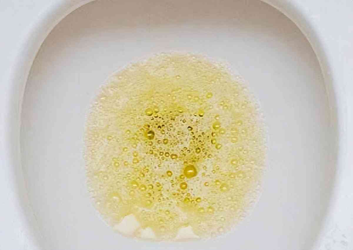 工作期间得肾病算工伤吗：肾炎能要求补偿及赔偿标准详解