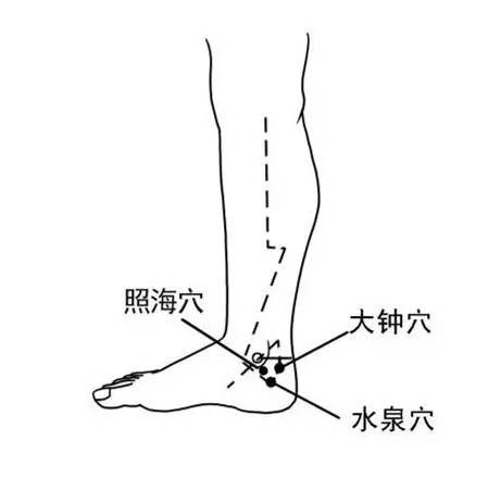 胫骨后肌腱炎能活动么：如何活动及恢复时间解析