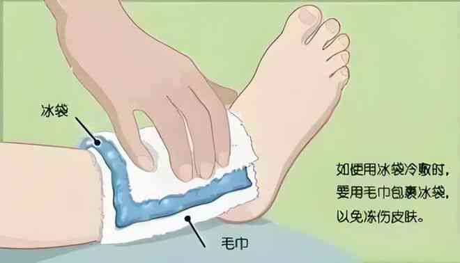 胯骨扭伤的有效治愈方法与复指南