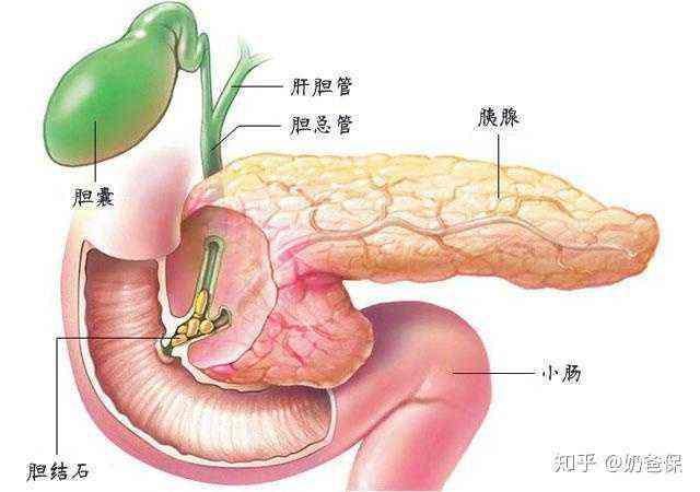 胰腺炎可以入大病保险吗，能报销多少钱及入保情况详解