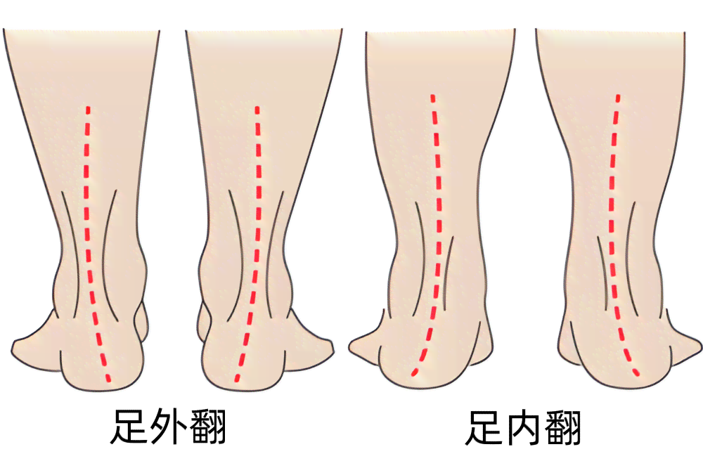 摔断胳膊后关节活动性分析：断裂后还能正常活动吗？