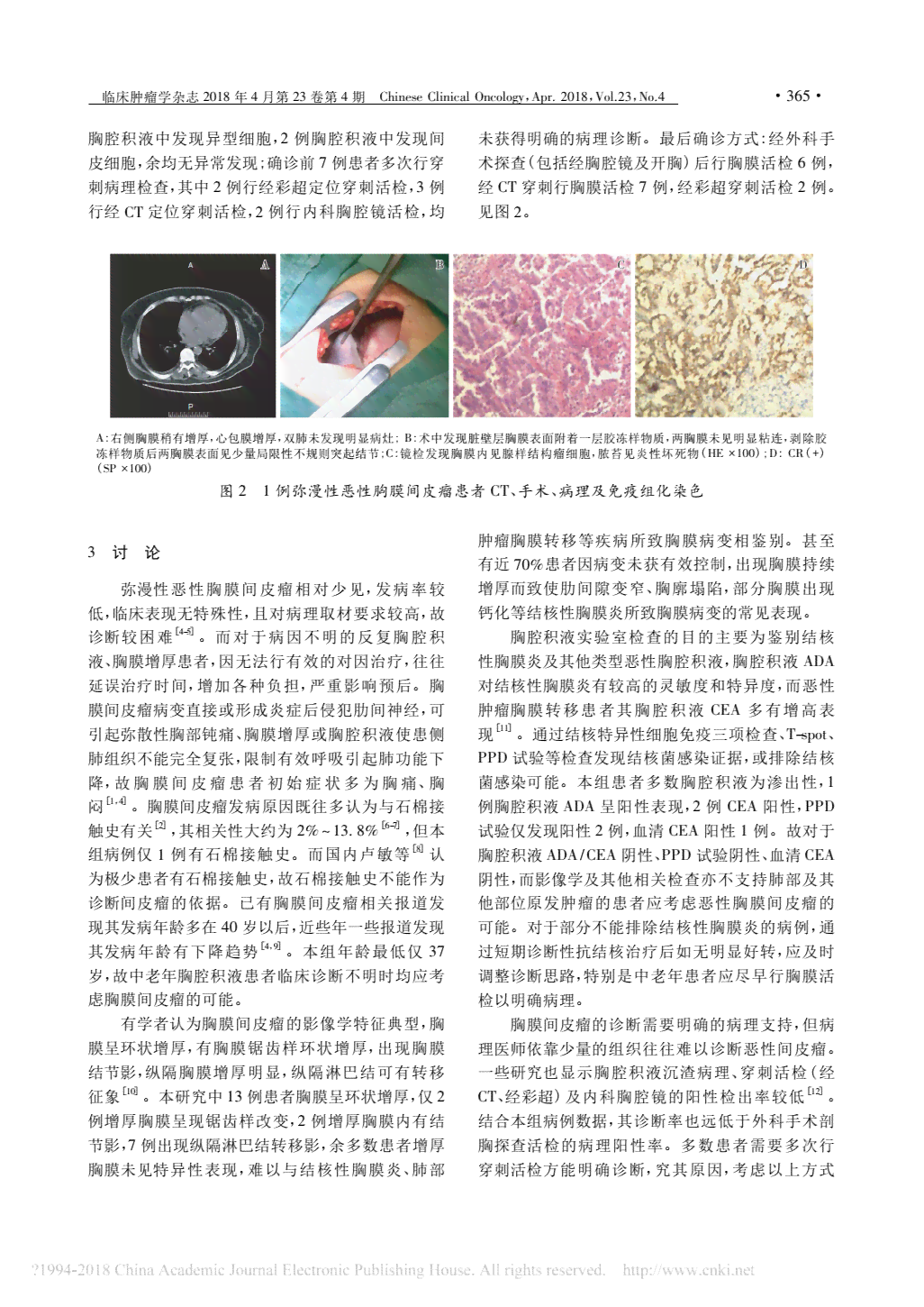 胸膜间皮瘤患者生存期限与治疗响应相关性探究
