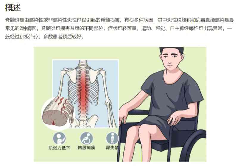 脊髓炎患者如何申请残疾评定及享受相关政策福利