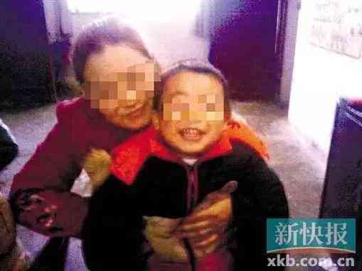 探讨脑出血病症在工伤等级认定中的具体标准与条件