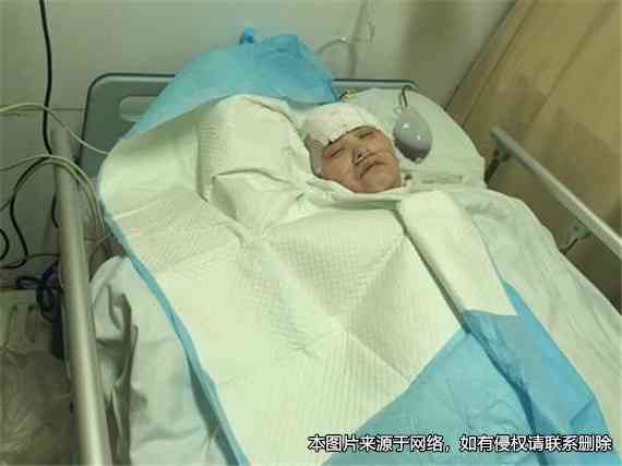 脑出血植物人可以申请残疾吗：何时申请残疾证及是否放弃治疗探讨