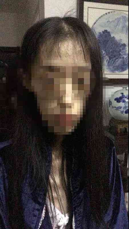 探讨脑出血导致的植物人状态治疗可能性与复前景