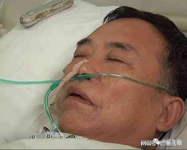 脑出血算不算工伤：工作时间内突发脑出血是否属于工伤险赔偿范围