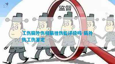 脑外伤综合征认定工伤