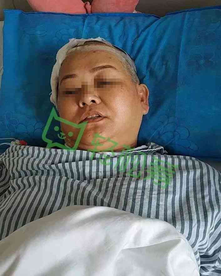 脑瘤手术可以认定工伤吗