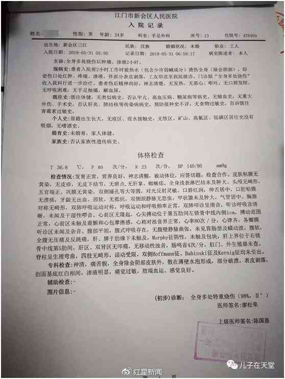 脸部烫伤能认定工伤吗