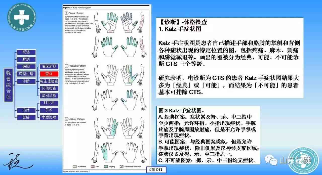 腕管综合征认定工伤