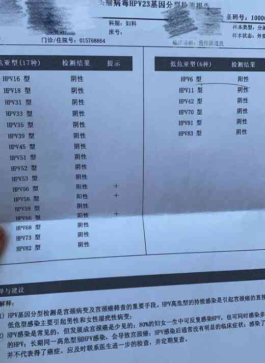 检查报告单上的Ai是什么意思