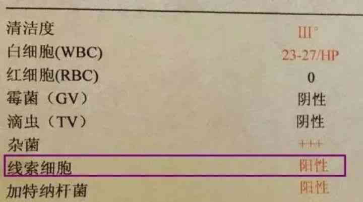 检查报告单上的Ai是什么意思