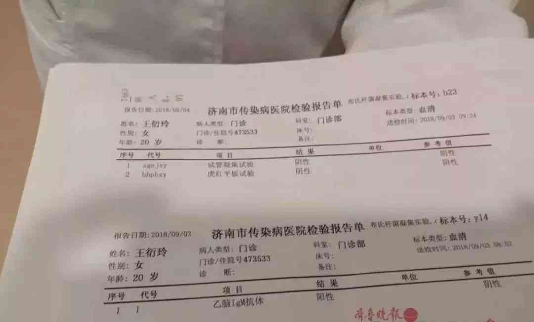 检查报告单上的Ai是什么意思