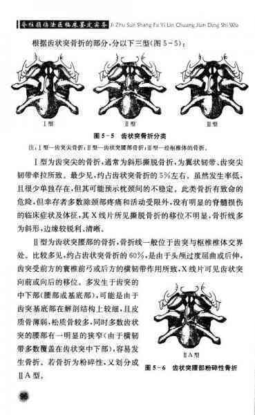 腰椎弧度变直能认定工伤
