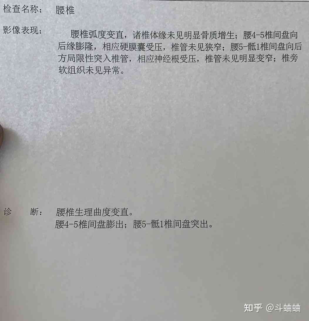 腰椎膨出认定工伤成功