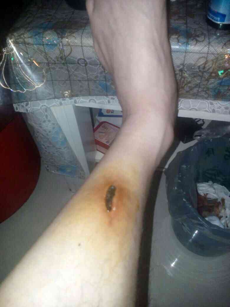 腿碰到肿了能认定工伤嘛