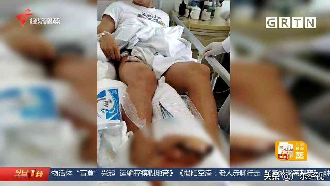 要不要认定工伤事故