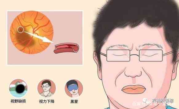 视神经萎缩可以认定工伤吗