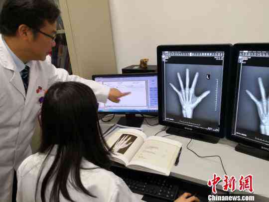 骨龄报告Ai靠谱吗