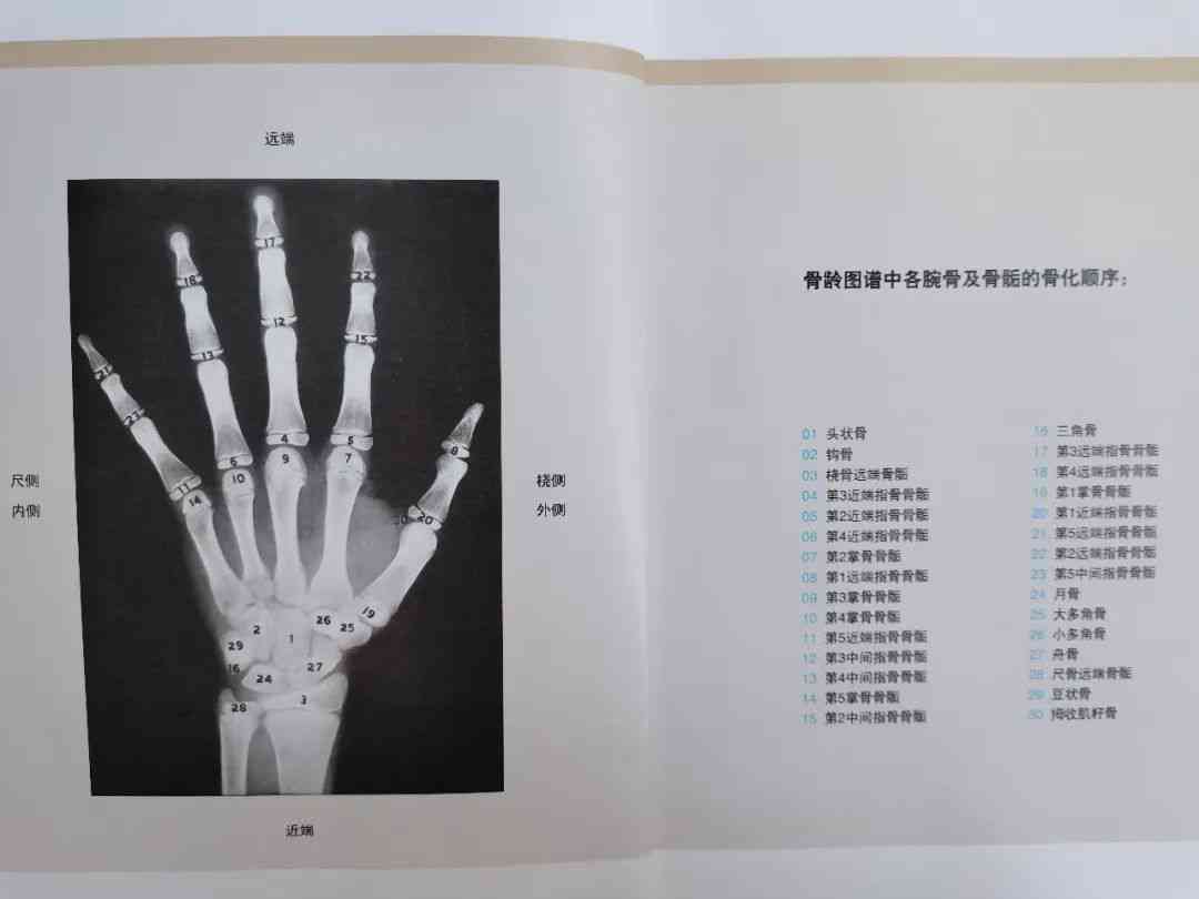 ai骨龄报告怎么看