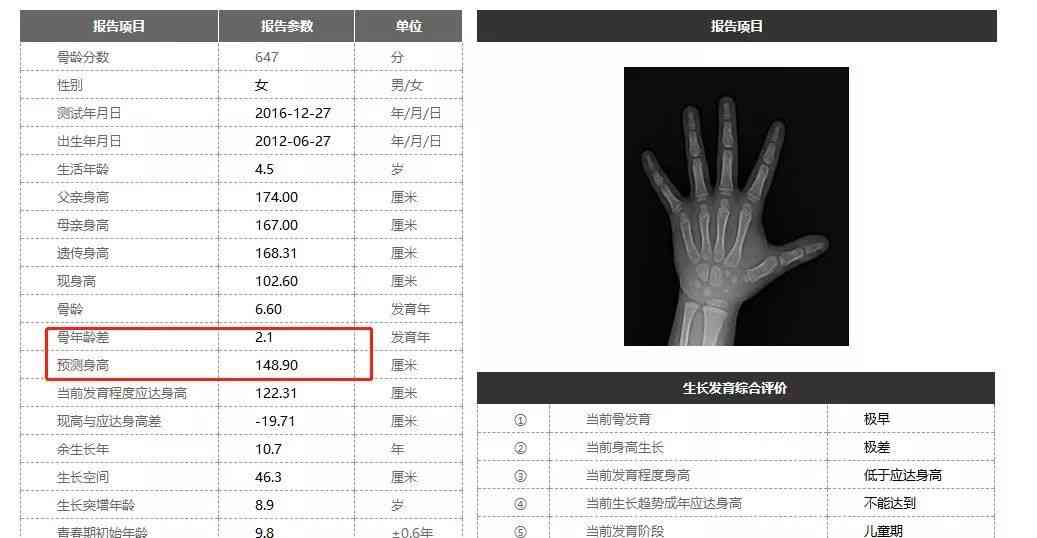 ai骨龄报告怎么看