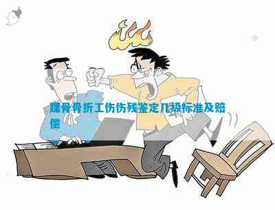 足踝撞击综合症能认定工伤