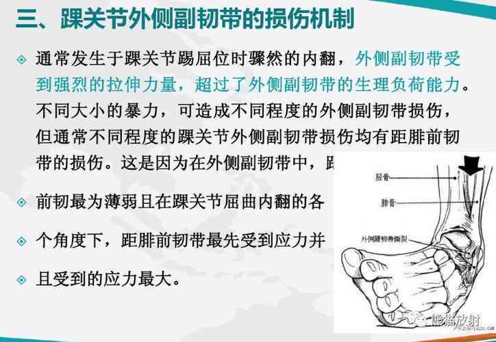 足踝撞击综合症能认定工伤