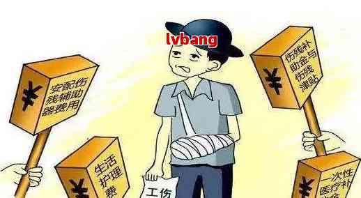 轻微伤认定工伤吗