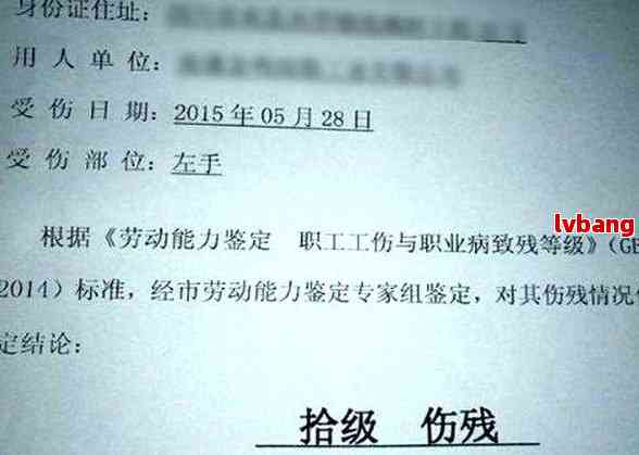 轻微擦伤可以认定工伤吗