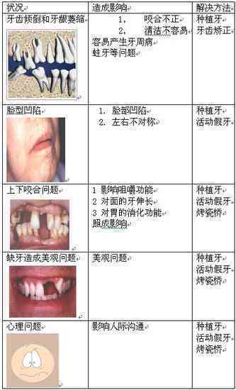 门牙摔断怎么认定工伤
