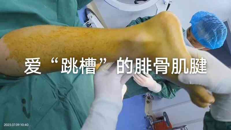 韧带损伤能认定工伤