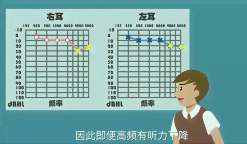 高频听阈多少可认定工伤
