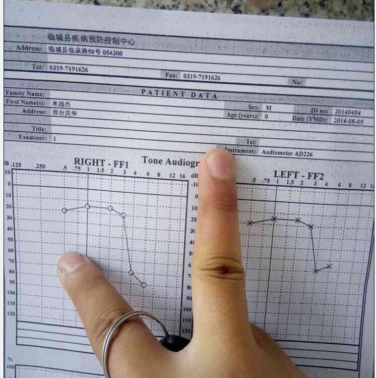 高频听阈多少可认定工伤