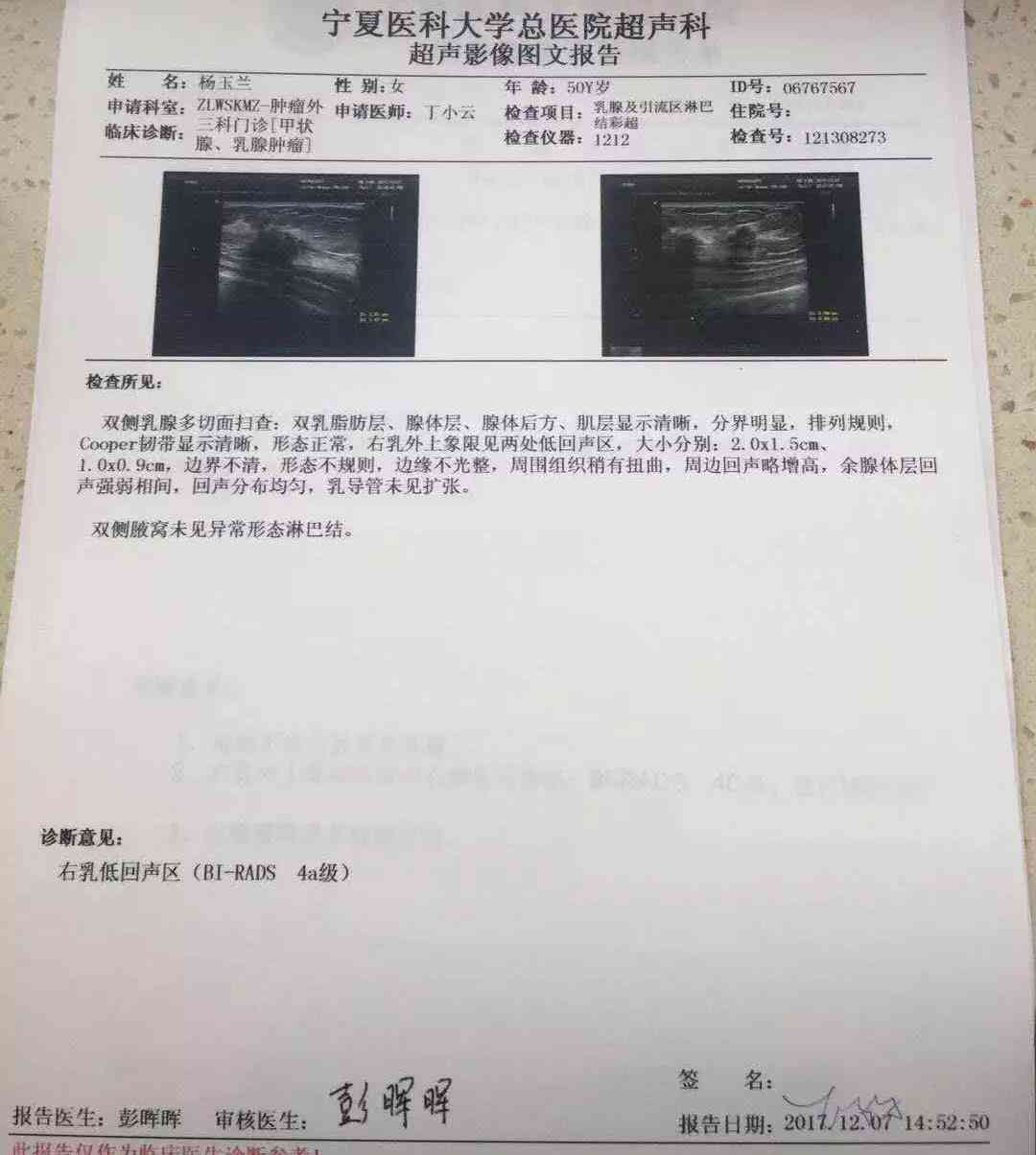 ai宫颈癌筛查报告多久出来