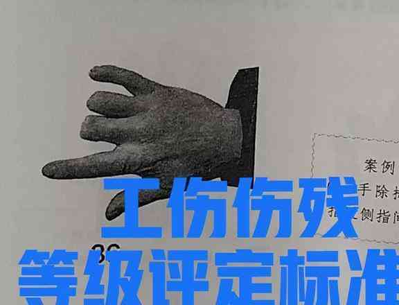 山工伤9级赔偿多少
