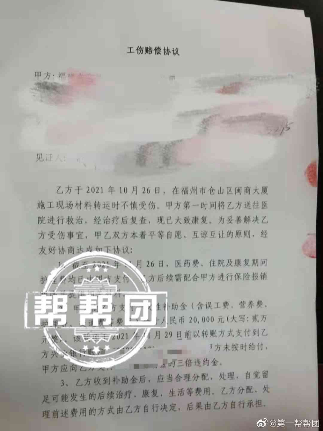 在公司受工伤赔偿误工费吗