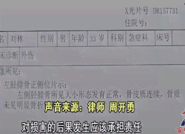工伤后的误工费营养费赔偿