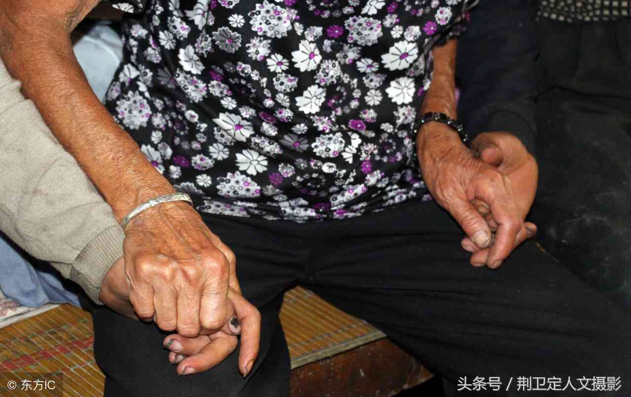 安徽工伤瘫痪赔偿多少钱