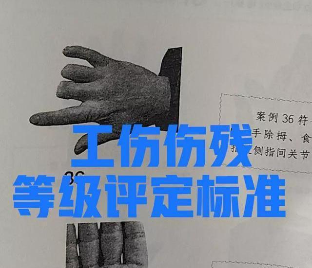 江西赣州工伤九级赔偿多少