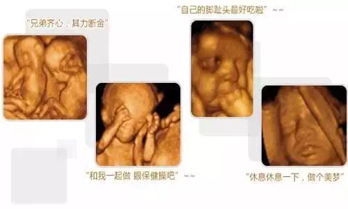 四维彩超ai免费生成文案